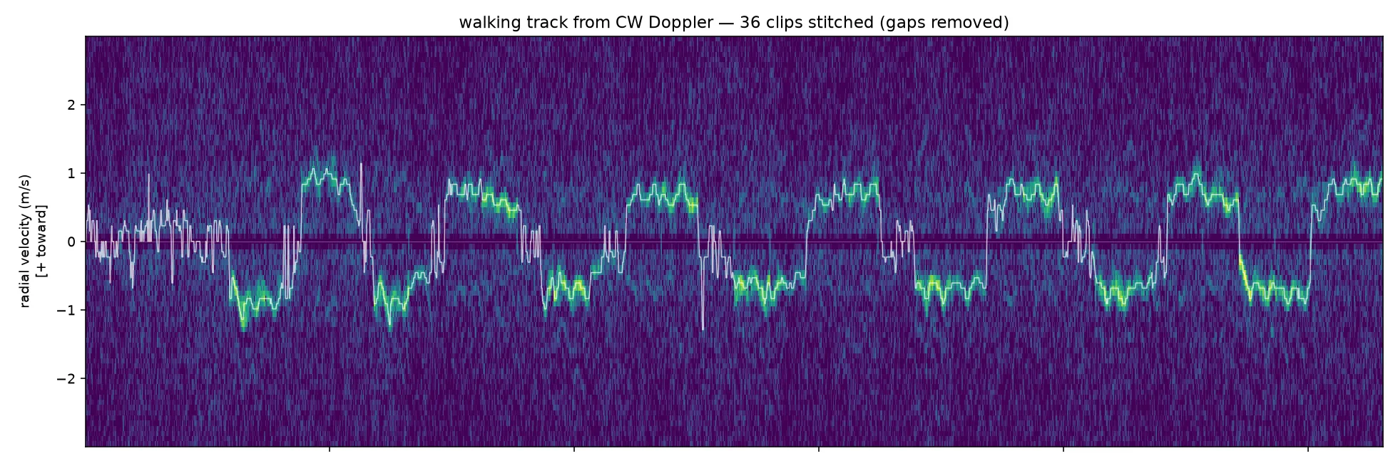 Doppler spectrogram from the RASD bench radar: a person walking back and forth appears as a repeating zigzag of positive and negative radial velocity around ±1 m/s, with a white tracked-peak line following the motion.